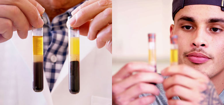 Esperimento analisi sangue documentario